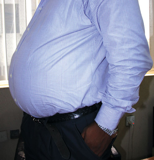 A man with a bulging belly