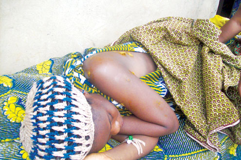 Miss â€˜Antelopeâ€™ Enechejo on her hospital bed.