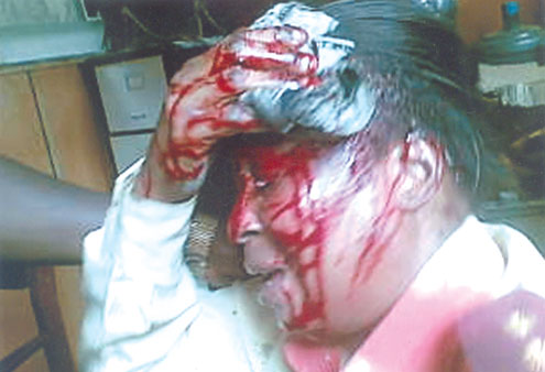 Mrs. Adegeye, knocked down by a vehicle.