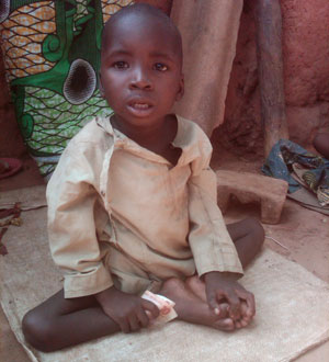 Usmanu, the polio victim in Kebbi state.