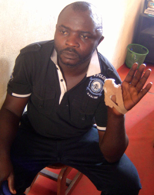 Okafor Nnaji lost his thumb to thugs