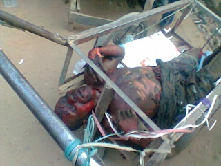 an injured victim being stretchered off the bomb scene in kano