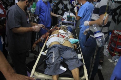 An injured Egyptian supporter (C) of the deposed Egyptian president Mohamed Morsi is given medical aid by doctors in a field hospital after clashes with riot policemen in Cairo early on July 27, 2013. 