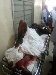 an injured victim of Kano blast