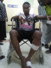 another injured victim of Kano blast