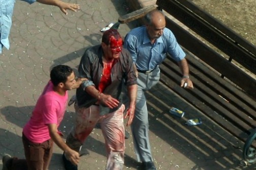 Egyptian Muslim brotherhood supporters of Egypt's ousted president Mohamed Morsi evacuate a wounded man during clashes with riot police at Cairo's Mustafa Mahmoud Square after security forces dispersed supporters Morsi on August 14, 2013. 