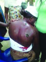 •An APC supporter shot by gunmen in Rivers State last week