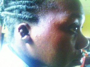 Chinwendu Nkemakolam whose ear was bitten off by her boss