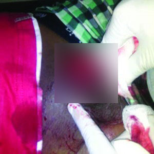 •Gory photos of the incident in Lagos