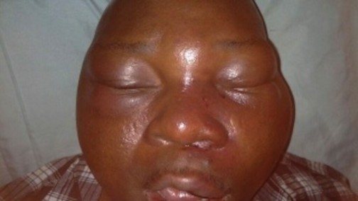 Yomi Olomofe battered by Customs officials