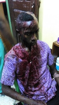 Taiwo Peter after he was battered and brutalized by police in Abeokuta