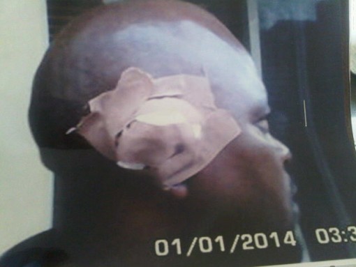 Chigozie Chukwu whose ear was cut off by neighbour