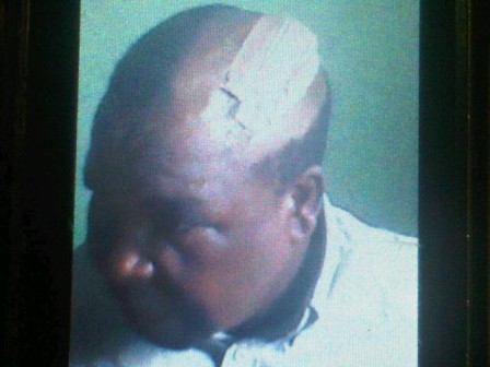 Elijah Oluwarotimi attacked with a  machete by his son