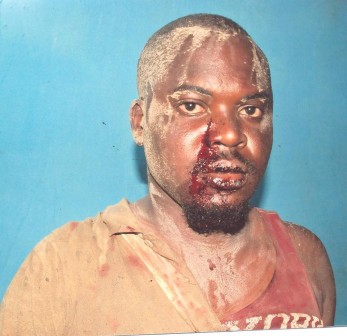 Tochukwu Onwuantudo after he was battered by suspected thugs in Lagos.