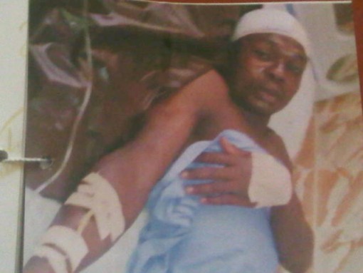 Chiwendu Sunday in hospital after he was attacked with a cutlass by his friend in a hotel room in Lagos