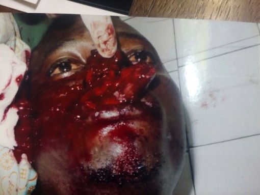 One of the injured persons Ile Epo Market Mayhem
