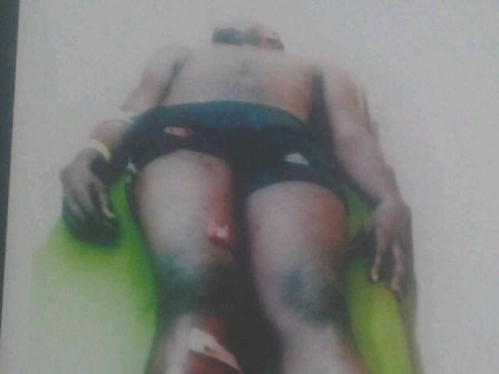 Anene Otasi at LUTH after suffering gun shot wounds at Ladipo market