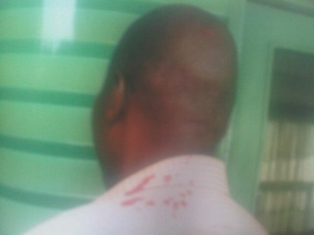 Inspector Balogun Johnson battered while on lawful duty by suspects