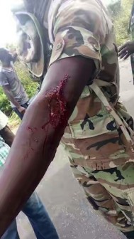 A soldier injured while trying to restore peace in the area