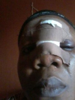 Gloria Izuakor battered by husband Jude
