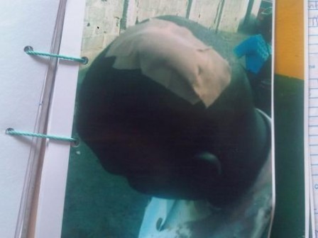 One of the VIO officials attacked by the duo