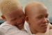 FILE PHOTO: Children with albinism