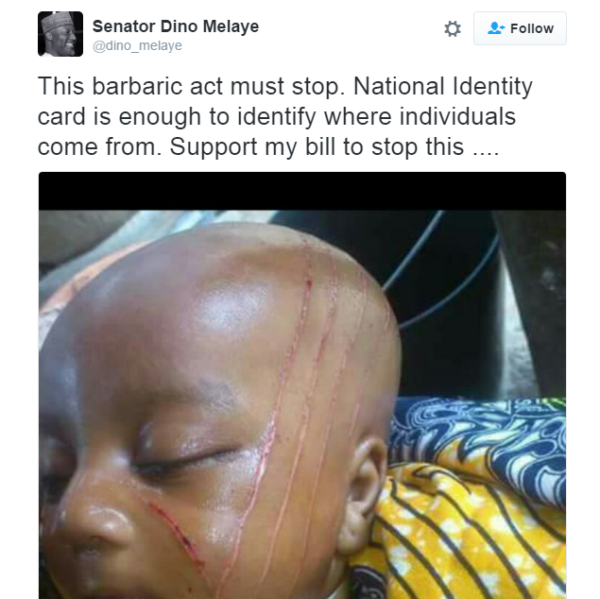 Toddler-with-fresh-tribal-marks