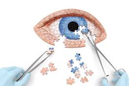 Eye Surgery