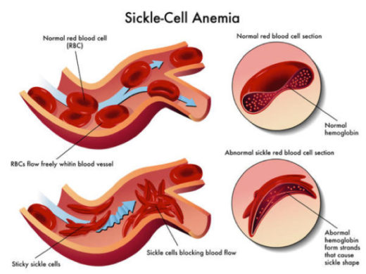 SCD-diagram