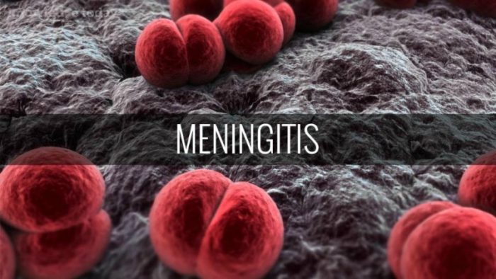 Meningitis