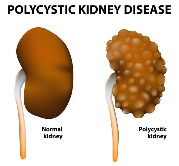 kidney