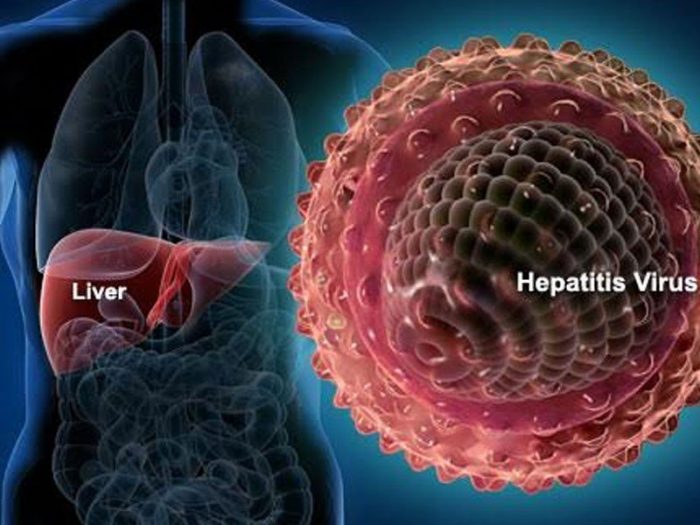 Hepatitis-B