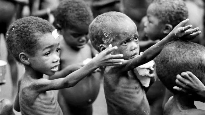 Starving-Child-Africa-Malnutrition