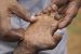 The Leprosy Mission Nigeria (TLMN) disclose that nearly 2, 500 new cases of leprosy are discovered annually in Nigeria.