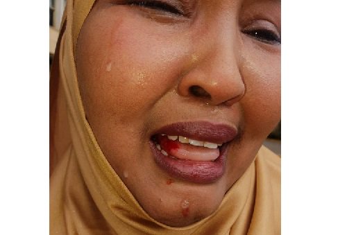 Female-MP-beaten-up-in-Kenya-by-colleague