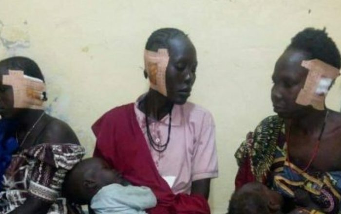 Women whose ears were sliced off by Boko Haram gunmen in Kalagari, Cameroon. Source: Cameroon-info.net