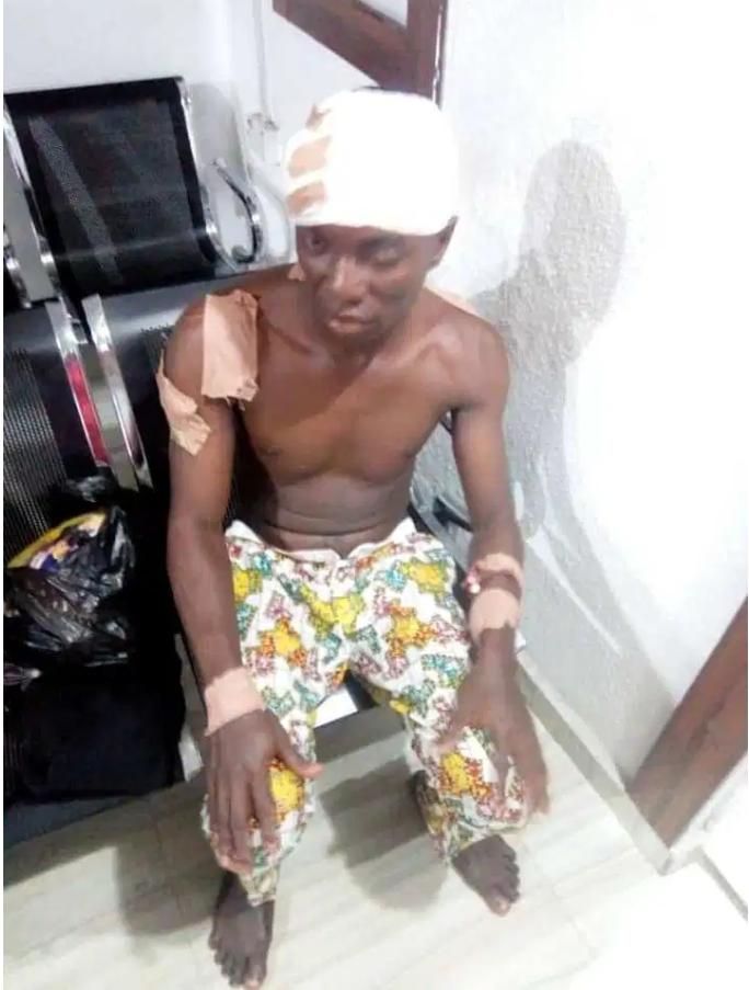 Elvis Omoiro the Buhari supporters stabbed by PDP supporter