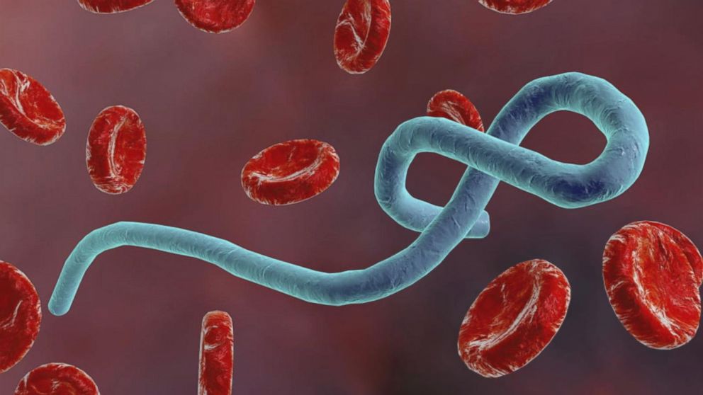 Ebola virus: more severe, dreadful, compared to coronavirus.