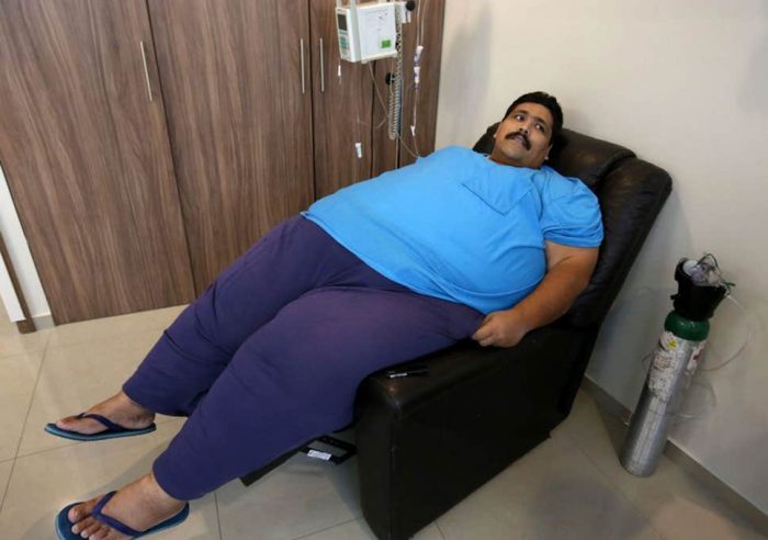 The late world’s Fattest man Andres Moreno – EPA
