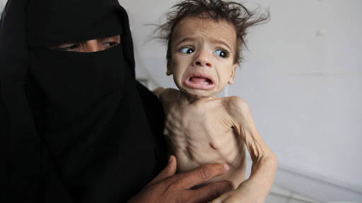 Yemen on the verge of famine