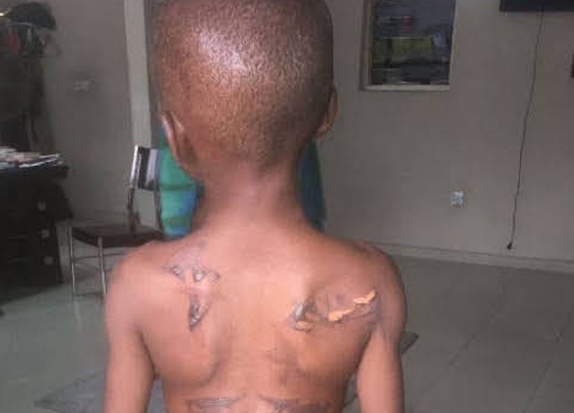 Nigerian boy rescued in calabar from wicked aunt