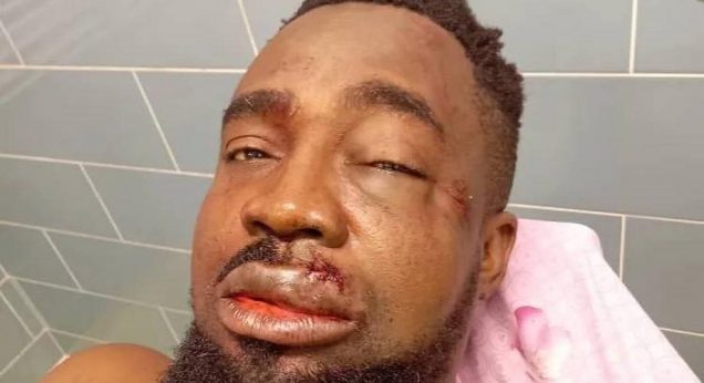 Mr Raw hospitalized after ghastly motor accident