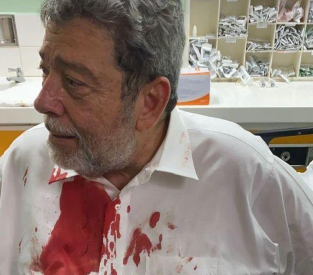 Injured Prime Minister Ralph Gonsalves