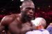 Deontay Wilder got several injuries in fight with Fury