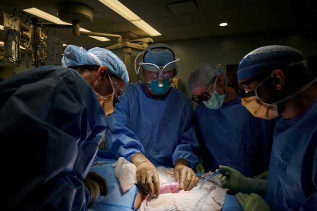US surgeons test pig kidney transplant in human patient