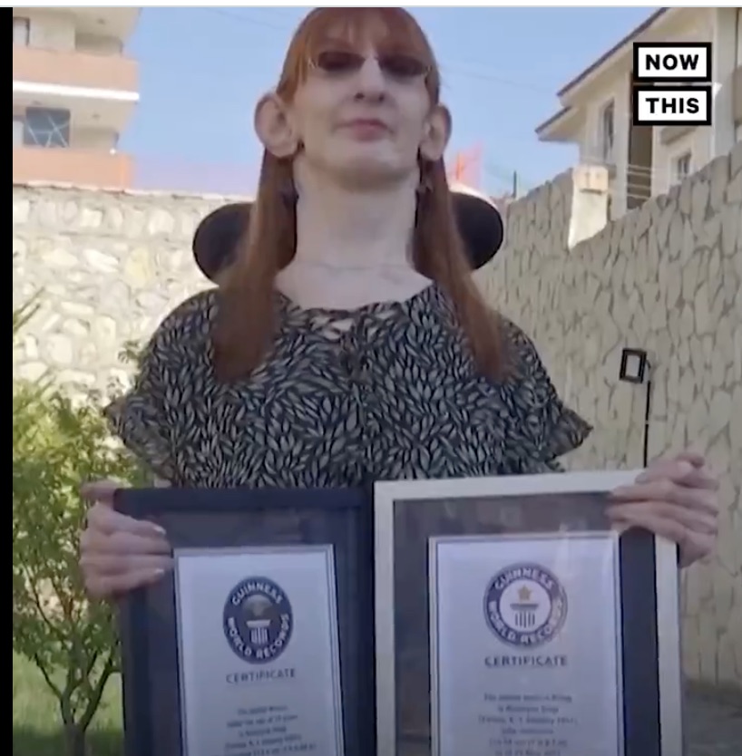 Rumeysa Gelgi with her Guinness records