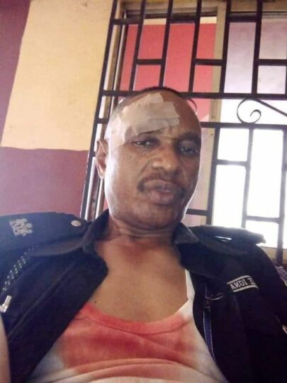 SP Alimeke Ignatius, the DPO of Obantoko police station with the injury he sustained when he was stoned during during clash between two schools in Abeokuta
