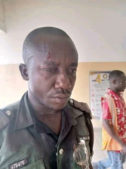 Police officer attached to Rivers State Taskforce on illegal Street Trading by with the injuries he sustained during clash with angry traders and hoodlums.