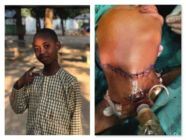Jubril Sadi Mato battling for survival after throat slit by senior student