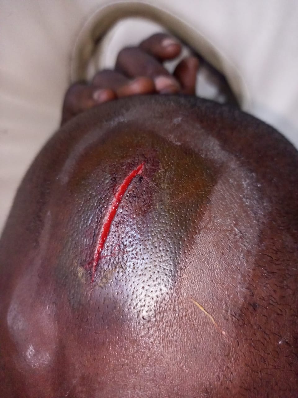 LASTMA officer cut in the head